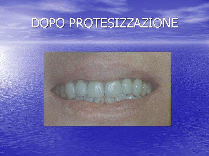 DOPO PROTESIZZAZIONE 