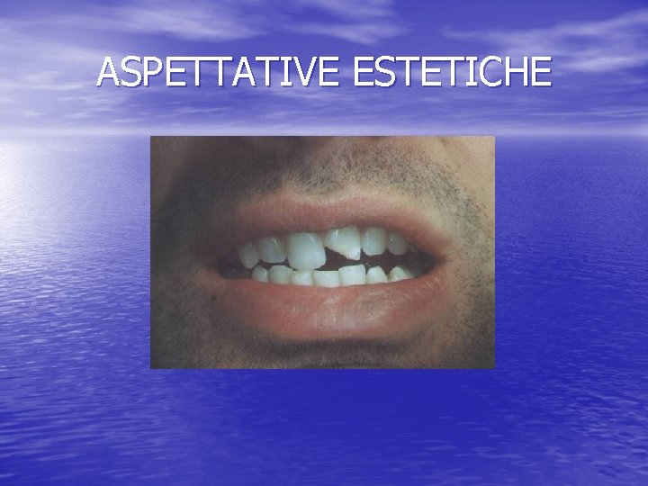 ASPETTATIVE ESTETICHE 