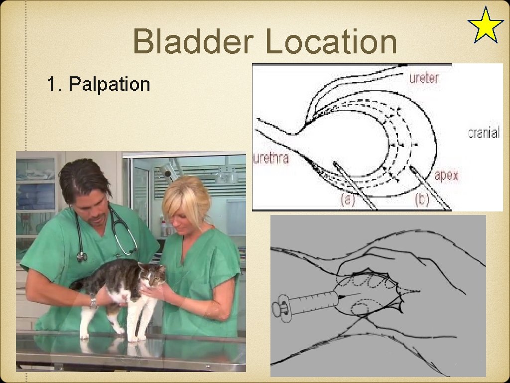 Bladder Location 1. Palpation 