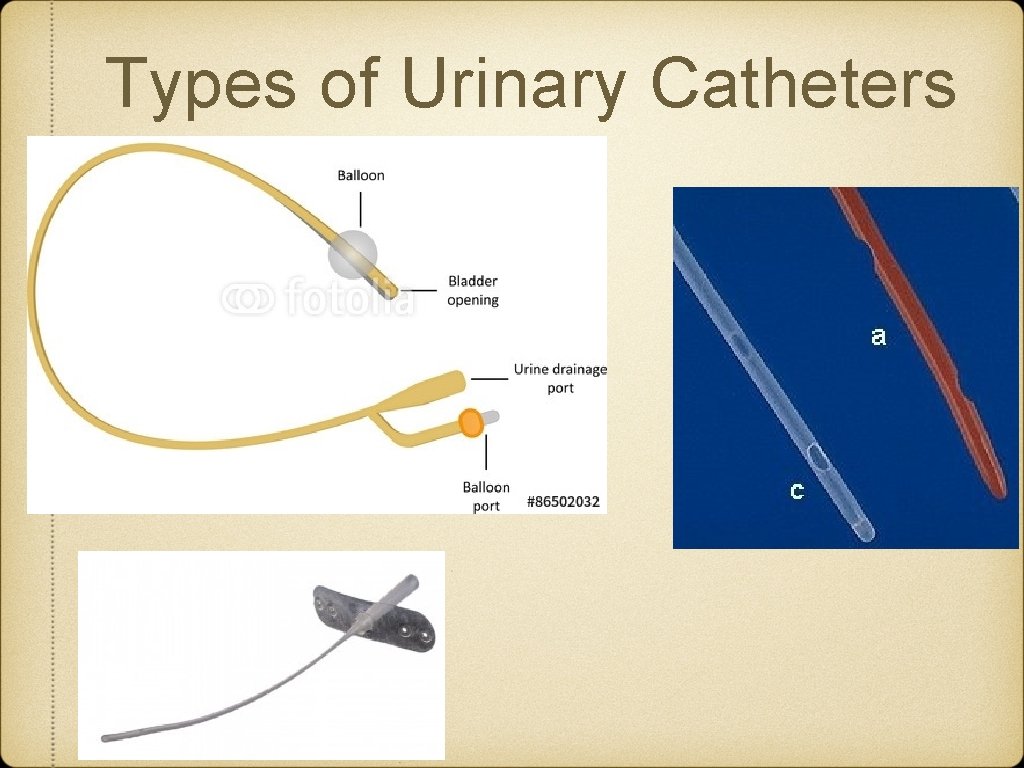 Types of Urinary Catheters 