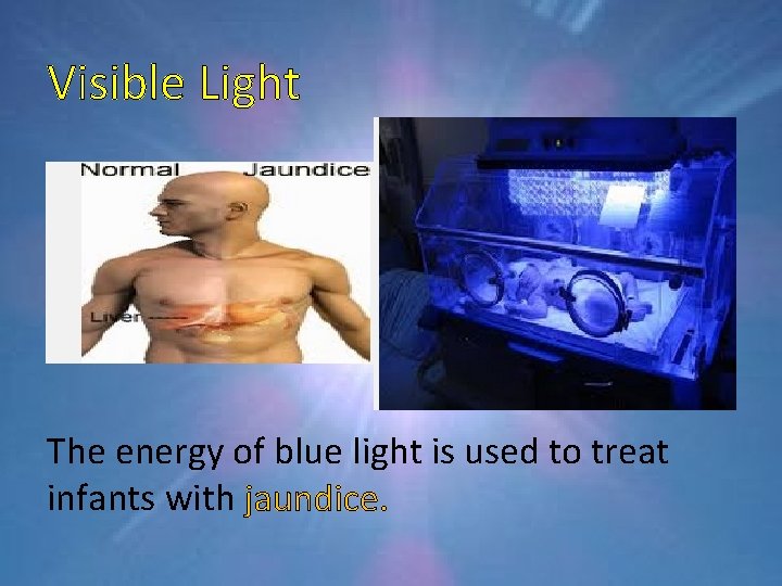 Visible Light The energy of blue light is used to treat infants with jaundice.