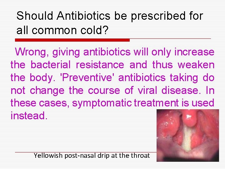 Should Antibiotics be prescribed for all common cold? Wrong, giving antibiotics will only increase Should Antibiotics be prescribed for all common cold? Wrong, giving antibiotics will only increase