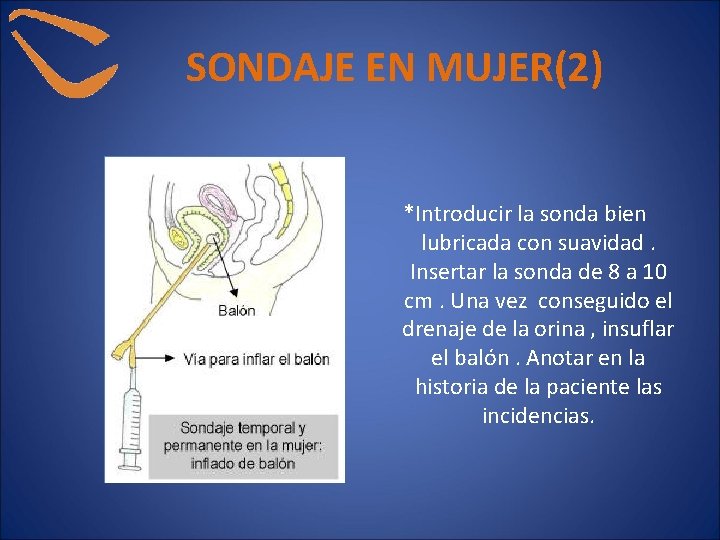 SONDAJE EN MUJER(2) *Introducir la sonda bien lubricada con suavidad. Insertar la sonda de