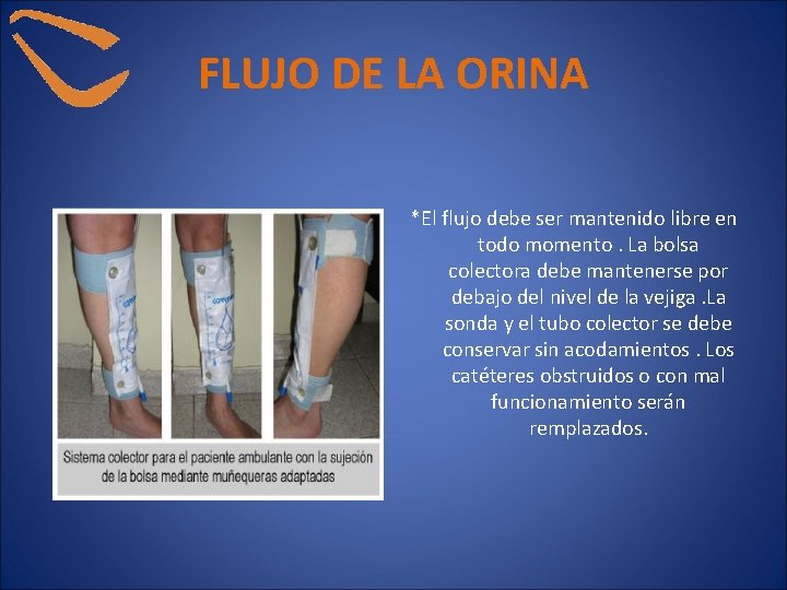 FLUJO DE LA ORINA *El flujo debe ser mantenido libre en todo momento. La