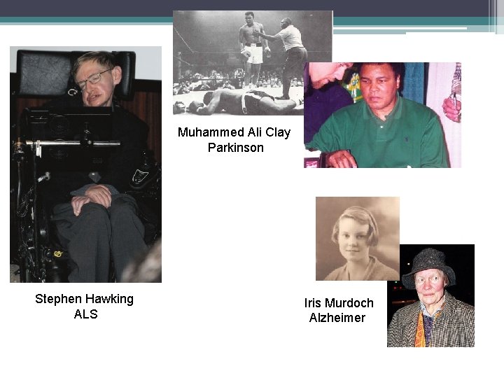 Muhammed Ali Clay Parkinson Stephen Hawking ALS Iris Murdoch Alzheimer Muhammed Ali Clay Parkinson Stephen Hawking ALS Iris Murdoch Alzheimer
