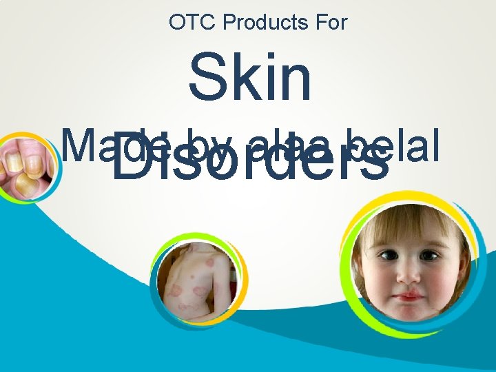 OTC Products For Skin Made by alaa belal Disorders 