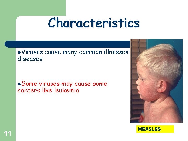 Characteristics l. Viruses diseases cause many common illnesses l. Some viruses may cause some