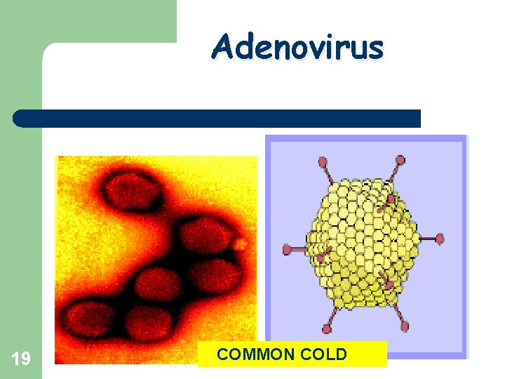 Adenovirus 19 COMMON COLD 