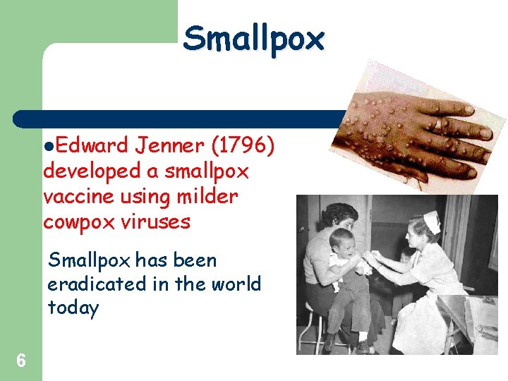 Smallpox l. Edward Jenner (1796) developed a smallpox vaccine using milder cowpox viruses Smallpox