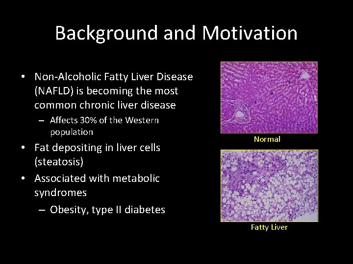 Background and Motivation • Non-Alcoholic Fatty Liver Disease (NAFLD) is becoming the most common