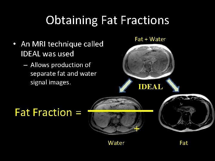 Obtaining Fat Fractions Fat + Water • An MRI technique called IDEAL was used