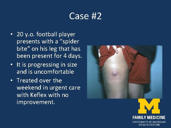 Case #2 • 20 y. o. football player presents with a “spider bite” on