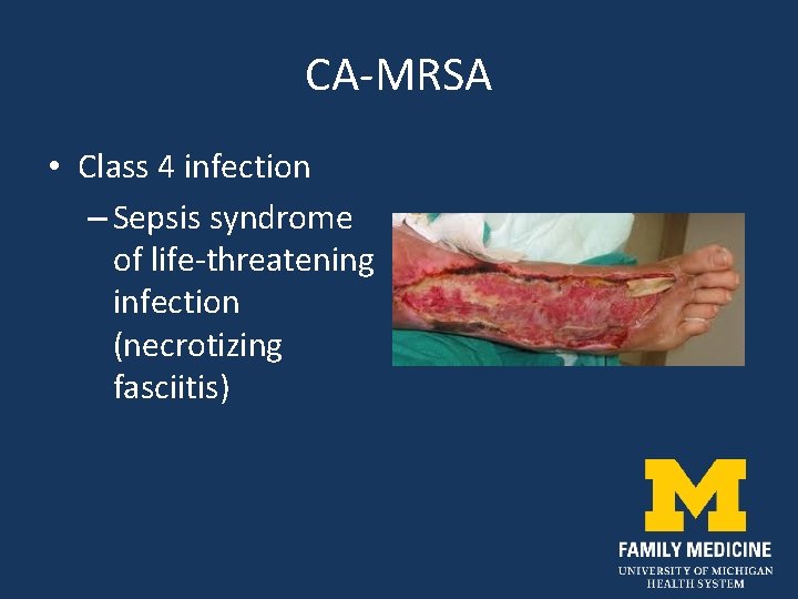 CA-MRSA • Class 4 infection – Sepsis syndrome of life-threatening infection (necrotizing fasciitis) 