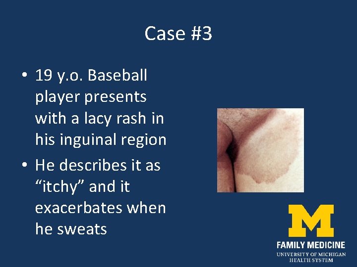 Case #3 • 19 y. o. Baseball player presents with a lacy rash in