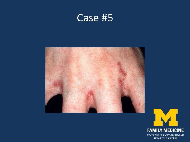 Case #5 