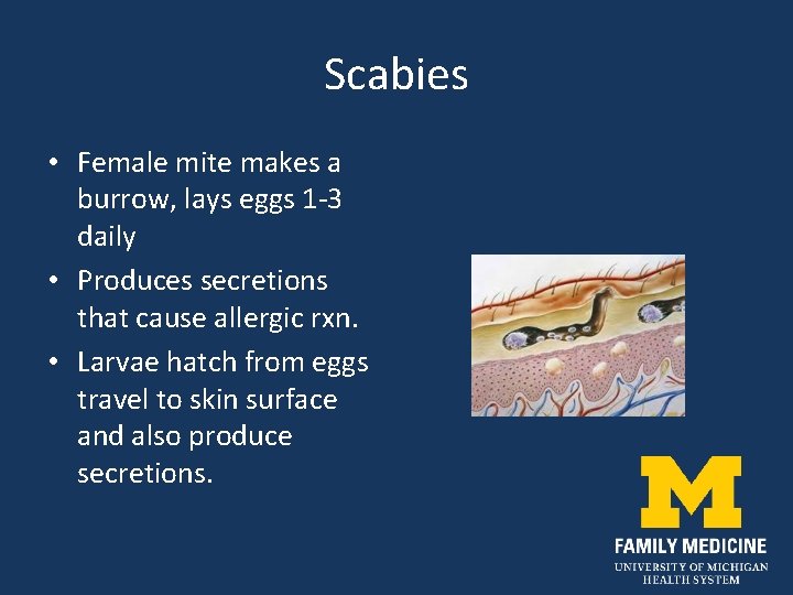 Scabies • Female mite makes a burrow, lays eggs 1 -3 daily • Produces