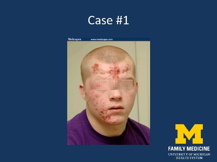 Case #1 
