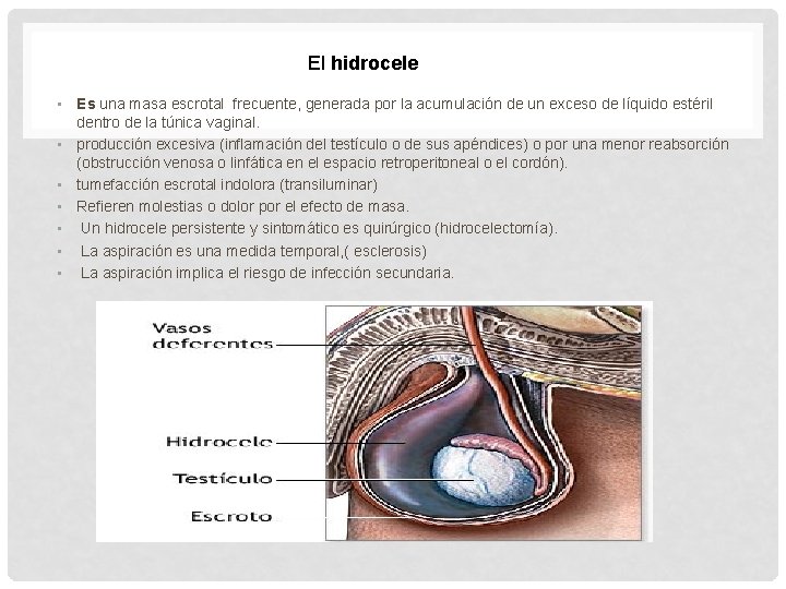 El hidrocele • Es una masa escrotal frecuente, generada por la acumulación de un