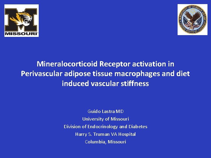 Mineralocorticoid Receptor activation in Perivascular adipose tissue macrophages and diet induced vascular stiffness Guido