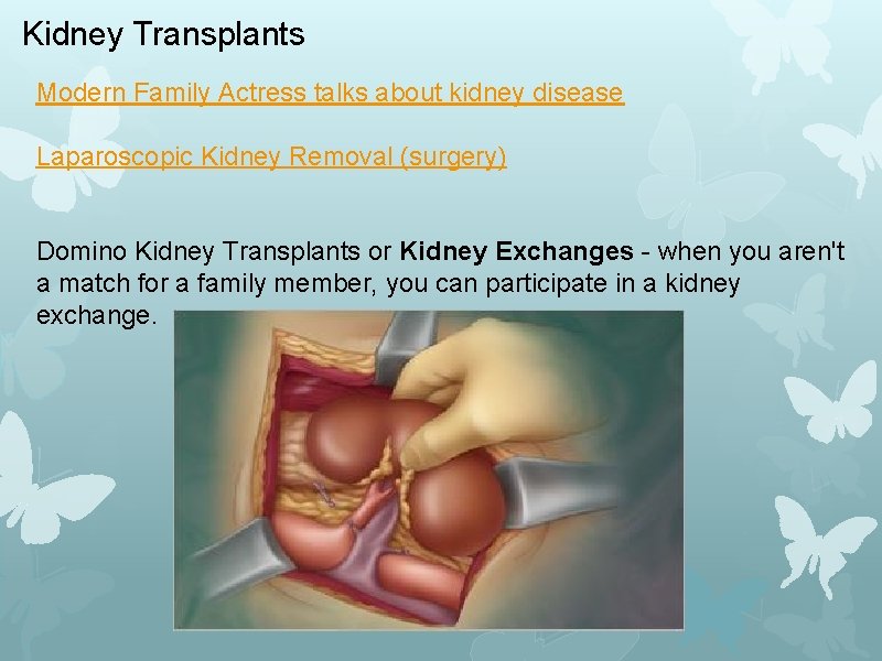 Kidney Transplants Modern Family Actress talks about kidney disease Laparoscopic Kidney Removal (surgery) Domino