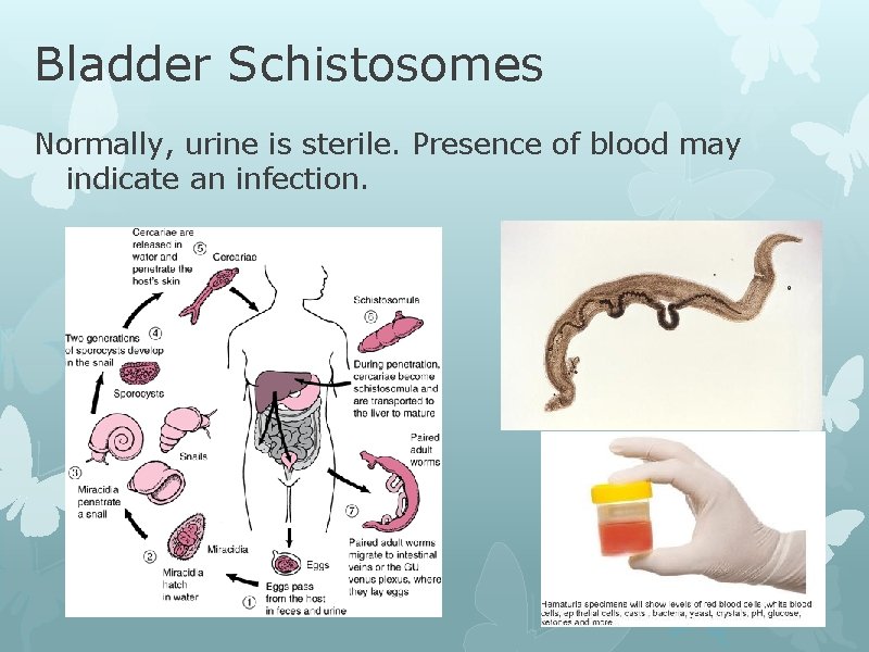 Bladder Schistosomes Normally, urine is sterile. Presence of blood may indicate an infection. 