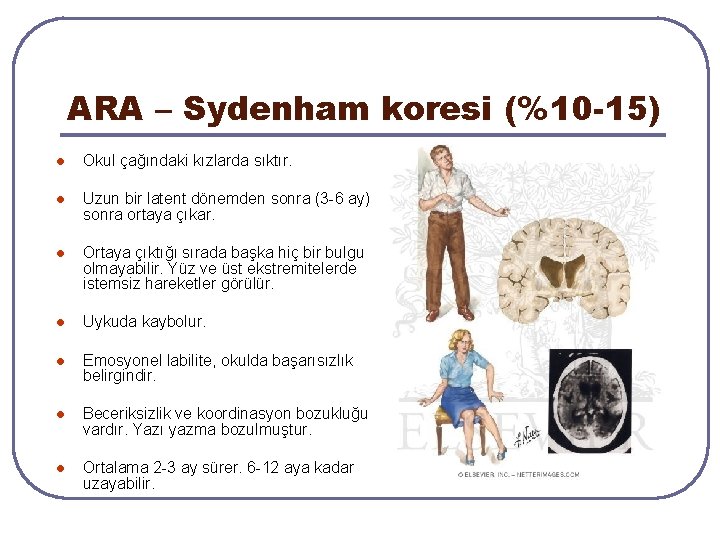 ARA – Sydenham koresi (%10 -15) l Okul çağındaki kızlarda sıktır. l Uzun bir ARA – Sydenham koresi (%10 -15) l Okul çağındaki kızlarda sıktır. l Uzun bir