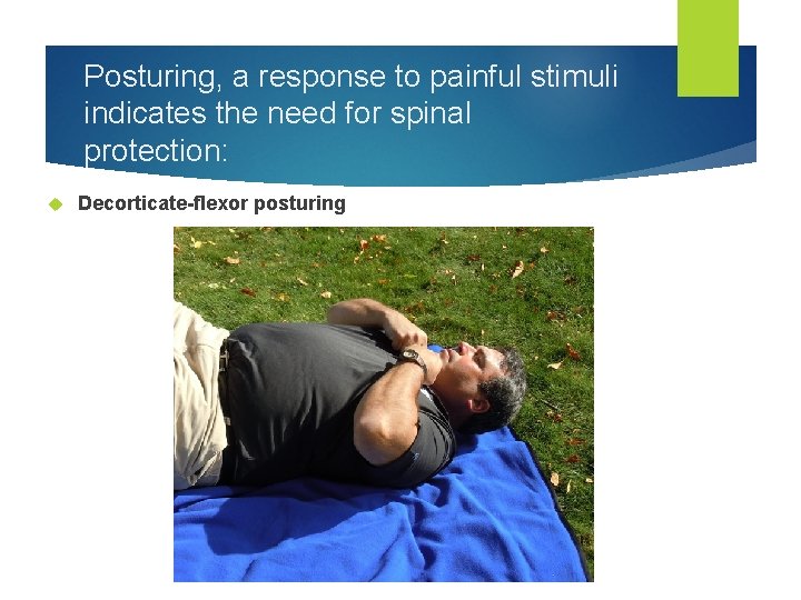 Posturing, a response to painful stimuli indicates the need for spinal protection: Decorticate-flexor posturing