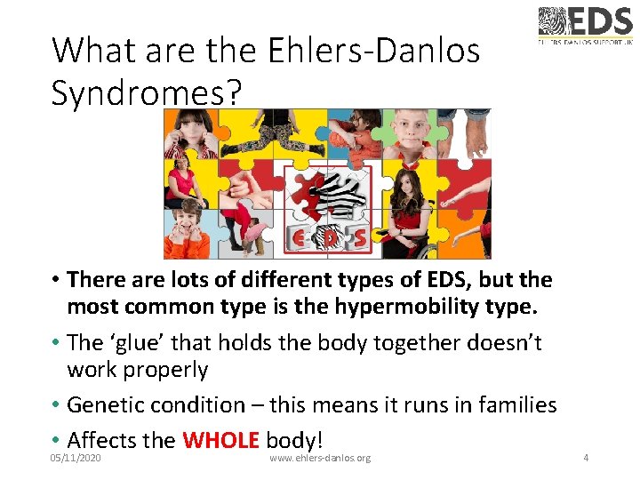 What are the Ehlers-Danlos Syndromes? • There are lots of different types of EDS, What are the Ehlers-Danlos Syndromes? • There are lots of different types of EDS,