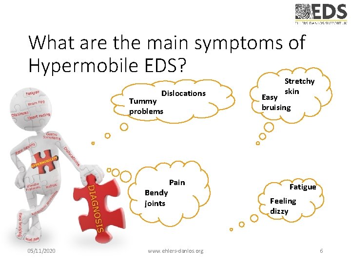 What are the main symptoms of Hypermobile EDS? Dislocations Tummy problems Bendy joints 05/11/2020 What are the main symptoms of Hypermobile EDS? Dislocations Tummy problems Bendy joints 05/11/2020
