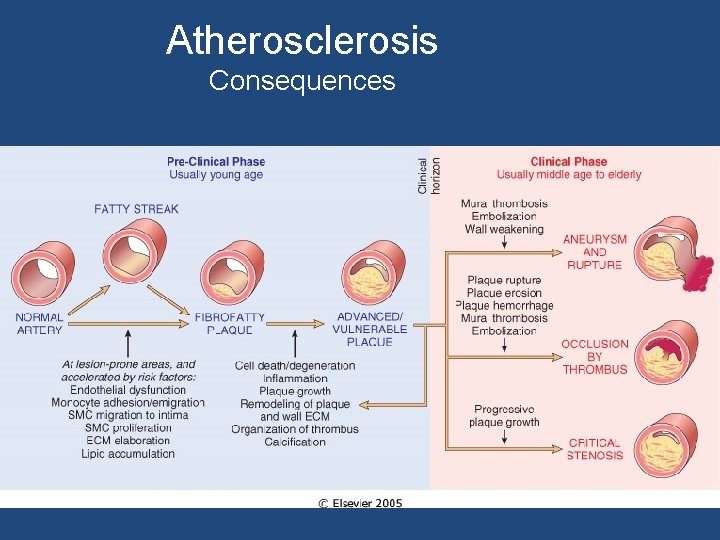 Atherosclerosis Consequences 