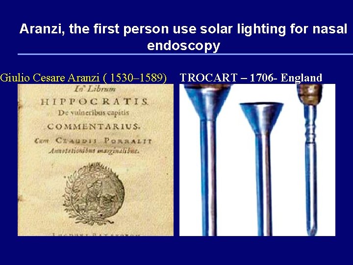 Aranzi, the first person use solar lighting for nasal endoscopy Giulio Cesare Aranzi (