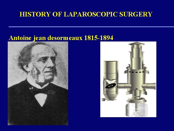 HISTORY OF LAPAROSCOPIC SURGERY Antoine jean desormeaux 1815 -1894 