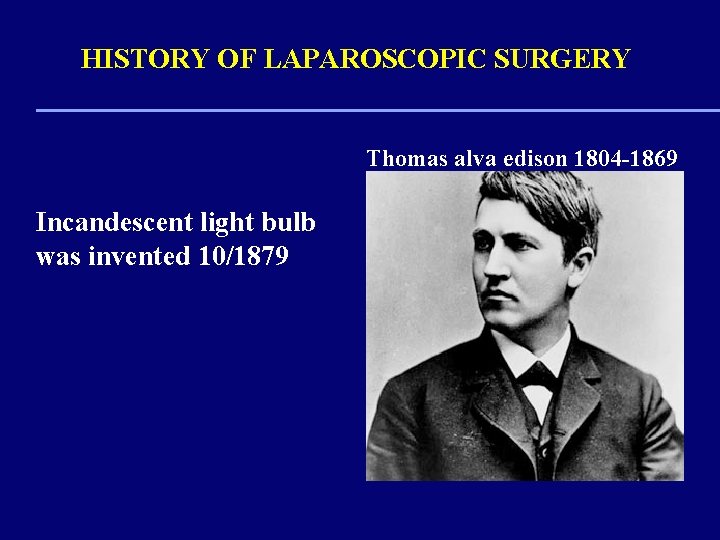 HISTORY OF LAPAROSCOPIC SURGERY Thomas alva edison 1804 -1869 Incandescent light bulb was invented