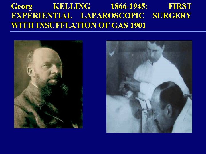 Georg KELLING 1866 -1945: FIRST EXPERIENTIAL LAPAROSCOPIC SURGERY WITH INSUFFLATION OF GAS 1901 