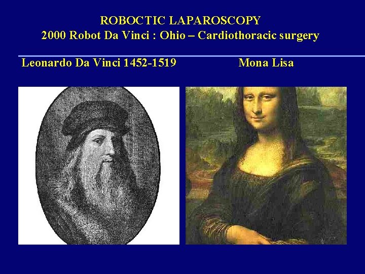 ROBOCTIC LAPAROSCOPY 2000 Robot Da Vinci : Ohio – Cardiothoracic surgery Leonardo Da Vinci