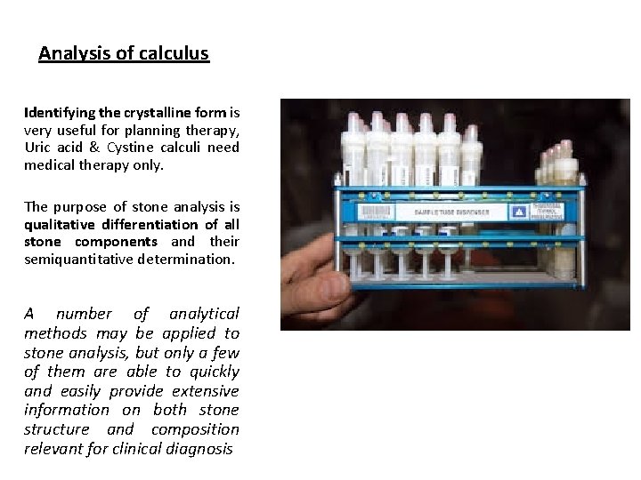 Analysis of calculus Identifying the crystalline form is very useful for planning therapy, Uric Analysis of calculus Identifying the crystalline form is very useful for planning therapy, Uric