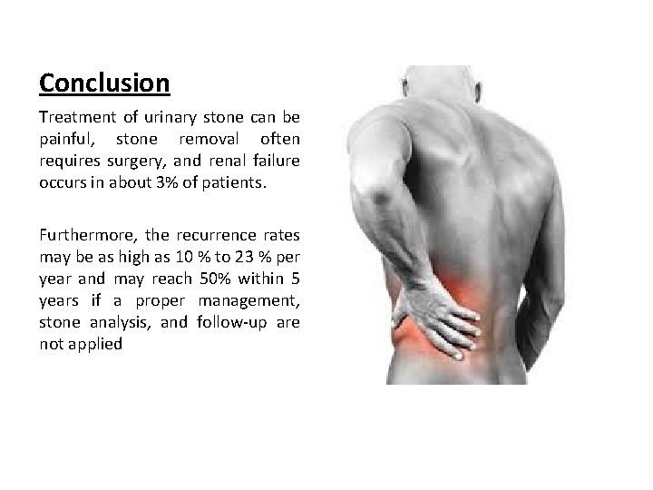 Conclusion Treatment of urinary stone can be painful, stone removal often requires surgery, and Conclusion Treatment of urinary stone can be painful, stone removal often requires surgery, and