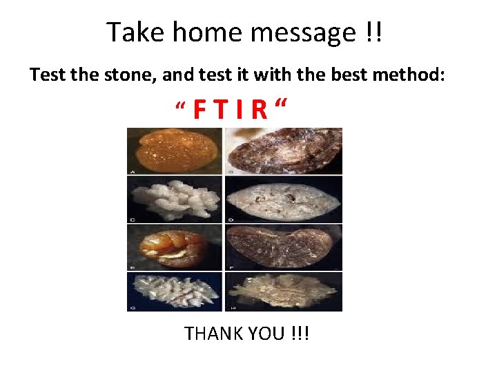 Take home message !! Test the stone, and test it with the best method: Take home message !! Test the stone, and test it with the best method: