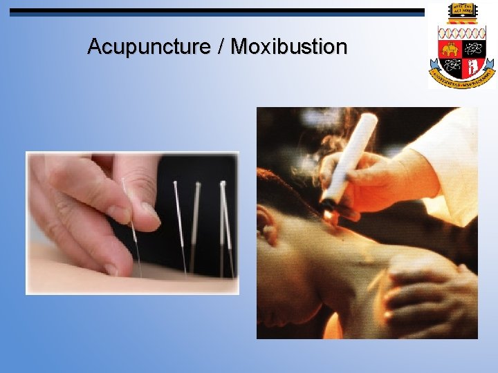 Acupuncture / Moxibustion 