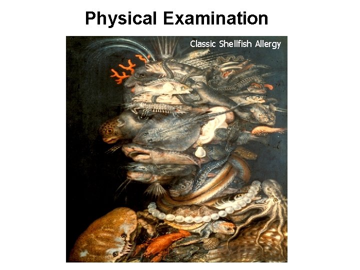 Physical Examination Classic Shellfish Allergy 