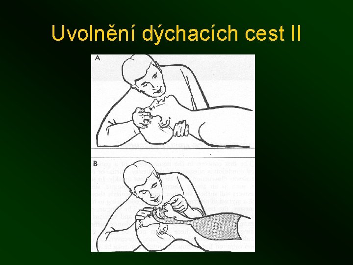 Uvolnění dýchacích cest II 