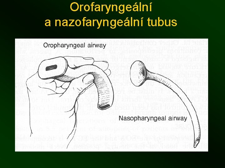 Orofaryngeální a nazofaryngeální tubus 