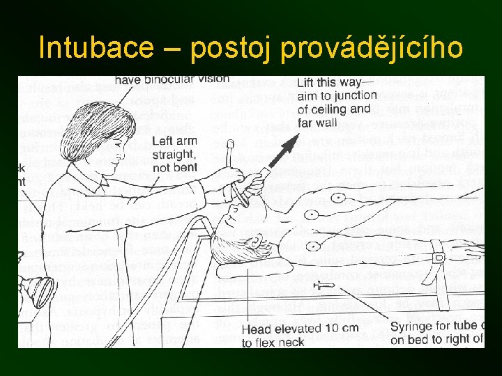 Intubace – postoj provádějícího 