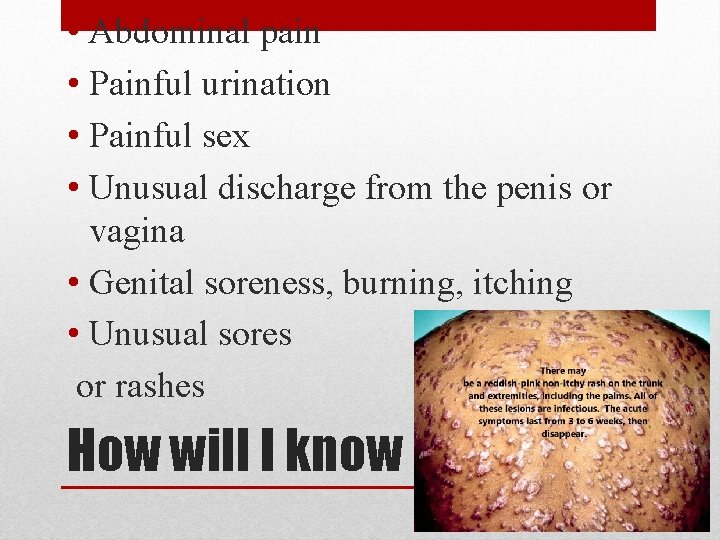  • Abdominal pain • Painful urination • Painful sex • Unusual discharge from