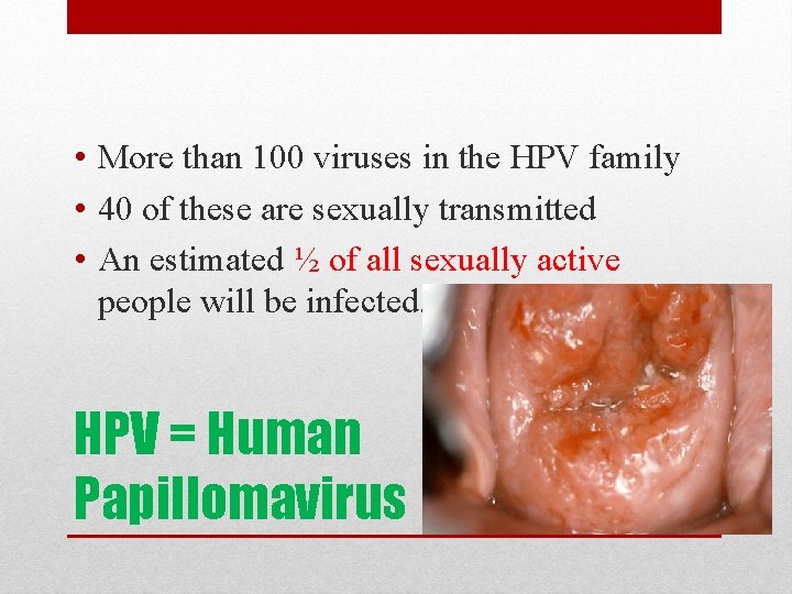  • More than 100 viruses in the HPV family • 40 of these
