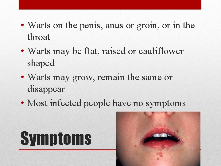  • Warts on the penis, anus or groin, or in the throat •