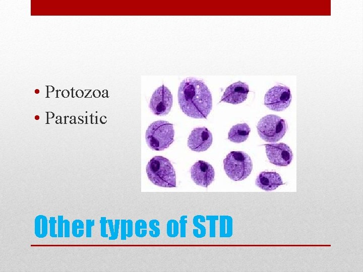  • Protozoa • Parasitic Other types of STD 