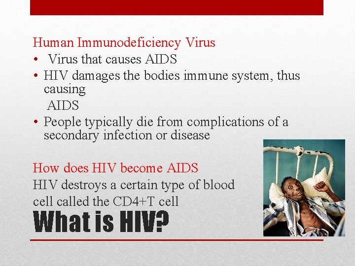 Human Immunodeficiency Virus • Virus that causes AIDS • HIV damages the bodies immune