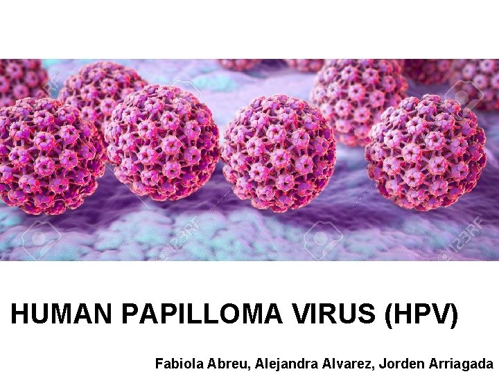 HUMAN PAPILLOMA VIRUS (HPV) Fabiola Abreu, Alejandra Alvarez, Jorden Arriagada 