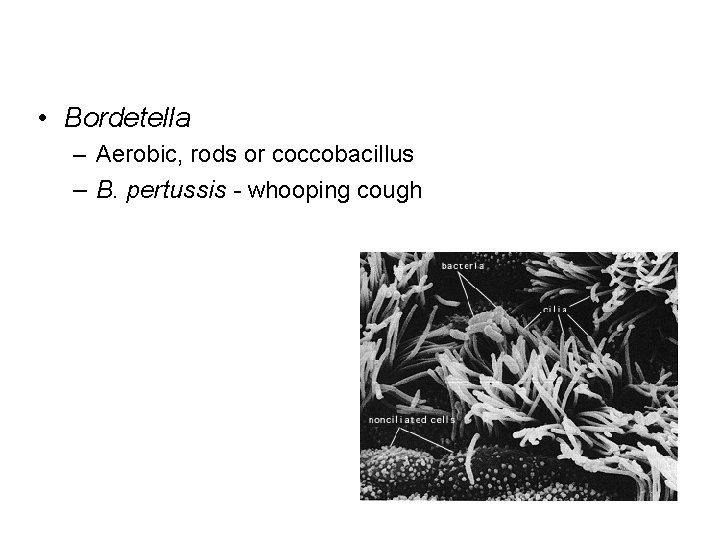  • Bordetella – Aerobic, rods or coccobacillus – B. pertussis - whooping cough